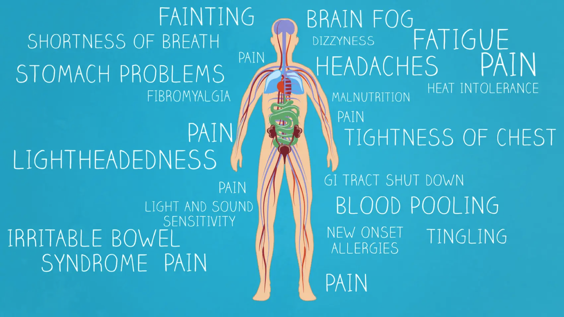 COVID induced POTS and Nervous system disorders