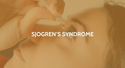 Sjogren’s Syndrome